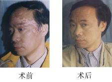 擺脫了多年白癜風困擾,天津西站醫院讓我重獲健康生活 擺脫了多年白癜風困擾,天津西站醫院讓我重獲健康生活