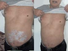 久治不愈，原來是沒有找對醫院