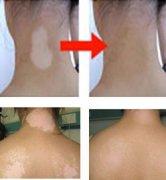 老人熱淚,只因激動謝醫院