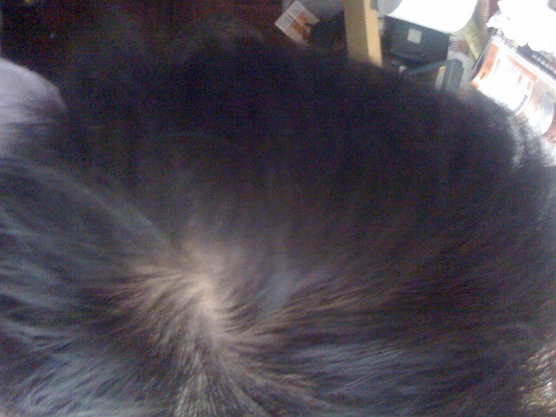 脫發癥狀圖 脫發癥狀圖